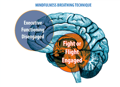 Brain-with-explanation
